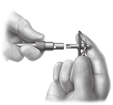 An Extra Small Glenoid Reamer is provided for each reamer type to aid the surgeon in the initial preparation.