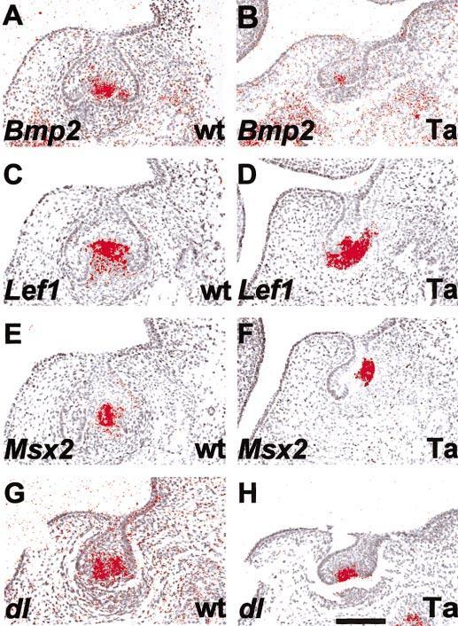TNF Signaling in Organogenesis 451 FIG. 6. Comparison of gene expression in the enamel knots between wild-type and Tabby mutant tooth germs.