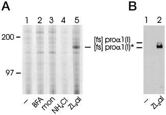 27396 Proteasomal Degradation of Unassembled 1(I) Procollagen FIG. 5.Effect of protease and vesicular transport inhibitors on degradation of mutant [fs]pro- 1(I) collagen.