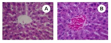 Histopathological Studies The sub-chronic treatment with SBSB at different dosages evaluated on present protocol did not induced negative features in hepatocytes