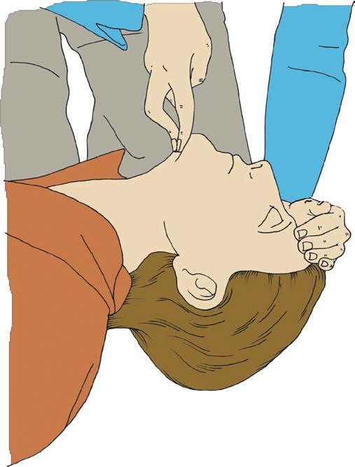 2005 European Resuscitation Council. index finger free to close his nose if rescue breathing is required (Figure 2.