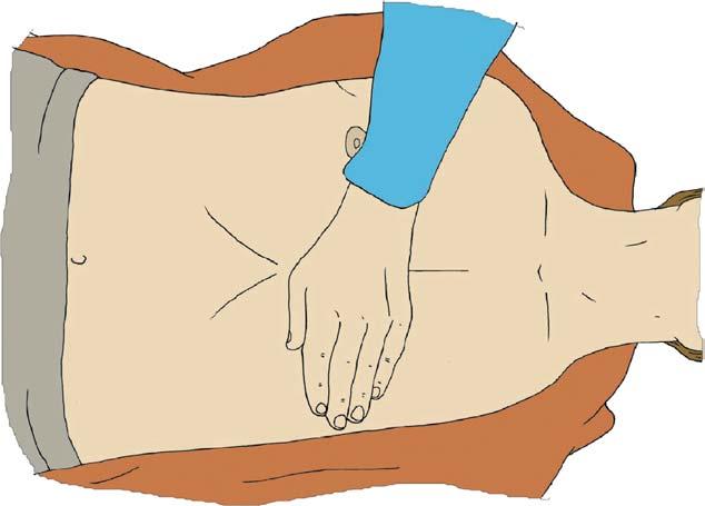 S10 A.J. Handley et al. Figure 2.7 The recovery position. 2005 European Resuscitation Council. more than 10 s to determine whether the victim is breathing normally.