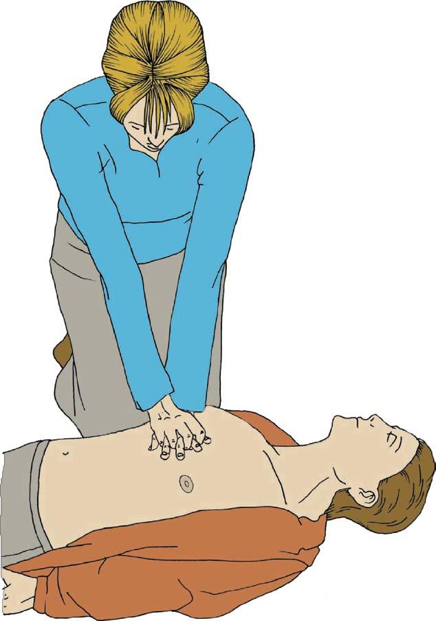 European Resuscitation Council Guidelines for Resuscitation 2005 S11 Figure 2.10 Interlock the fingers of your hands. 2005 European Resuscitation Council. Figure 2.11 Press down on the sternum 4 5 cm.