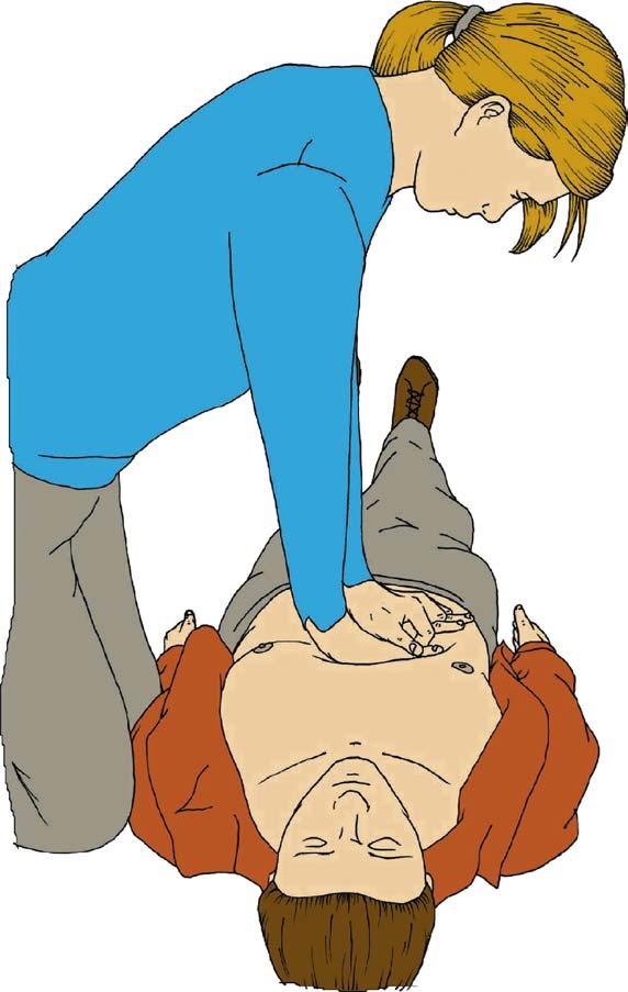 Then return your hands without delay to the correct position on the sternum and give a further 30 chest compressions. Continue with chest compressions and rescue breaths in a ratio of 30:2.