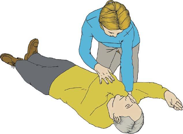 Check breathing regularly. Figure 2.16 Bring the far arm across the chest, and hold the back of the hand against the victim s cheek nearest to you. 2005 European Resuscitation Council.