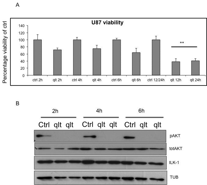 Fig 1 effect of the inhibitor of ILK-1 QLT0267 on U87 cells. (A) Viability of U87 cells at 2h, 4h, 6h, 12h and 24h after QLT0267 treatment with MTS assay (** p<0.