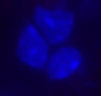 lymphocytes isolated from the mouse