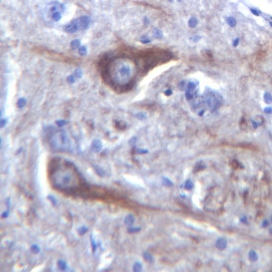 from the nucleus. Yellow arrows point to examples of cells that qualified as activated astrocytes.