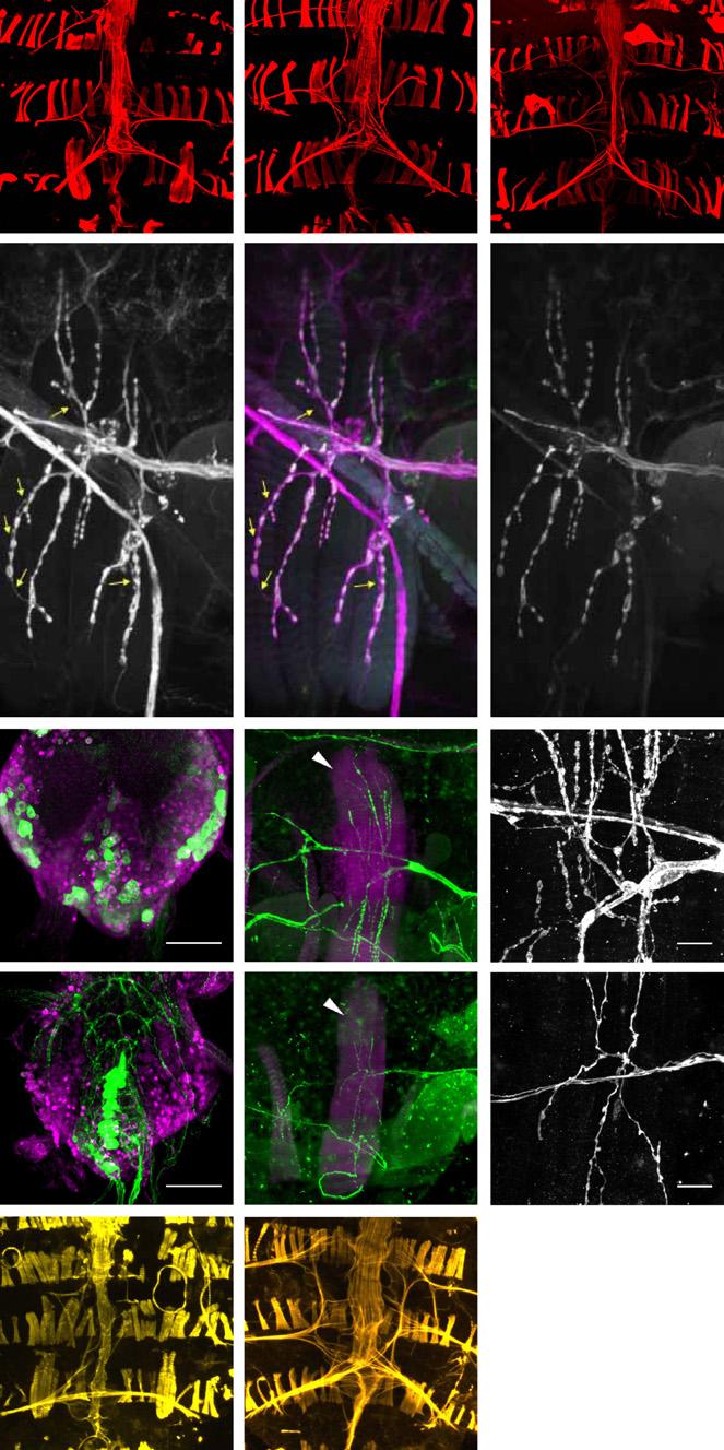 -Expression of Dsx F in developing P1 neurons of females activates a cell death program. Kimura et al.,(2008) Nojima et al.