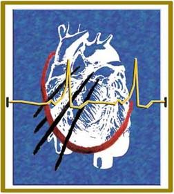 Long-Term Outcome and Risks of Catheter Ablation for Atrial