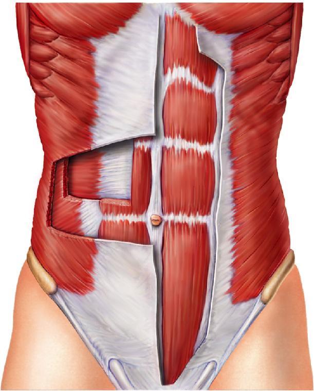 Figure 6.16b Muscles of the anterior trunk, shoulder, and arm. (b) Muscles of the abdominal wall.