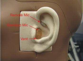 While the increase in gain before feedback is related to the microphone relocation, it was considered that other factors such as the fit of the device and the venting of the device are probably also