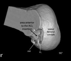 lower position Anatomic