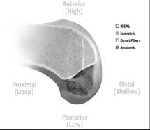 Reconstruction most functional and isometric region of ACL Reconstruction most functional and isometric region of ACL Reconstruction of most functional and isometric
