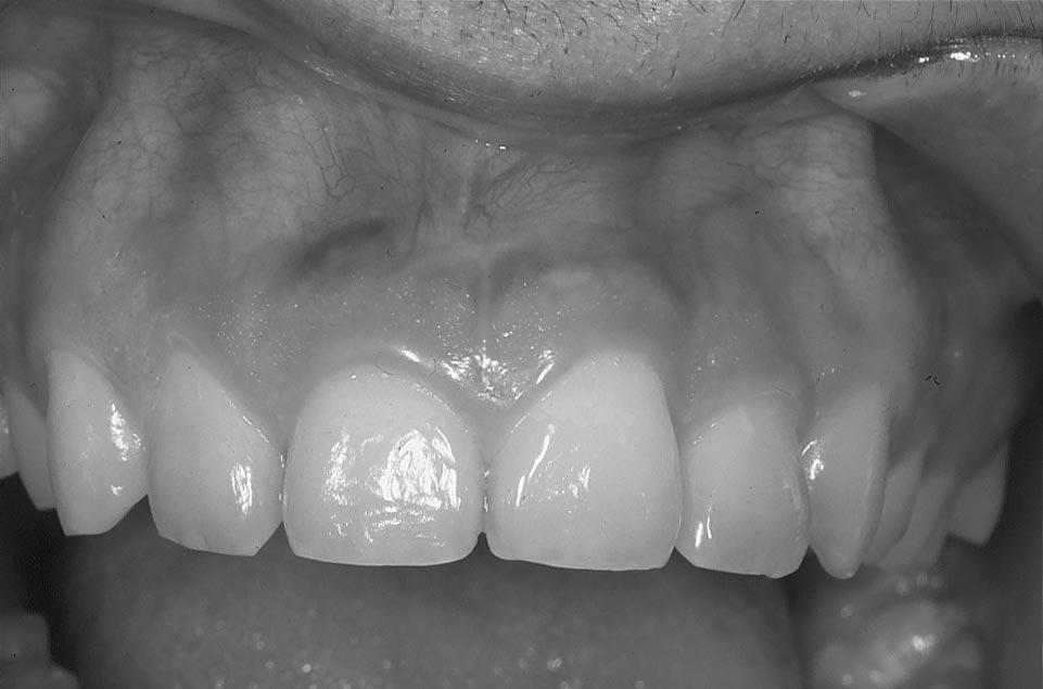 470 L.A. Morrow et al. / Journal of Dentistry 28 (2000) 469 473 Fig. 1.