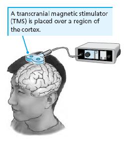 TMS transcranial