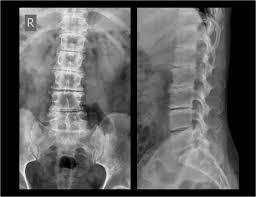 Imaging in Spine Disorders Search