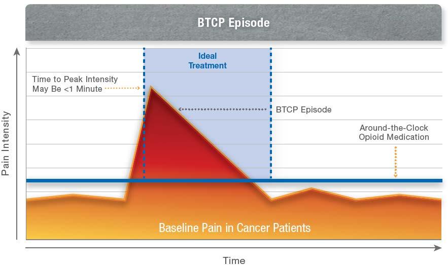 Ideal Management of Breakthrough Cancer Pain The ideal treatment for BTCP would match the temporal characteristics of BTCP as much as possible Unlike