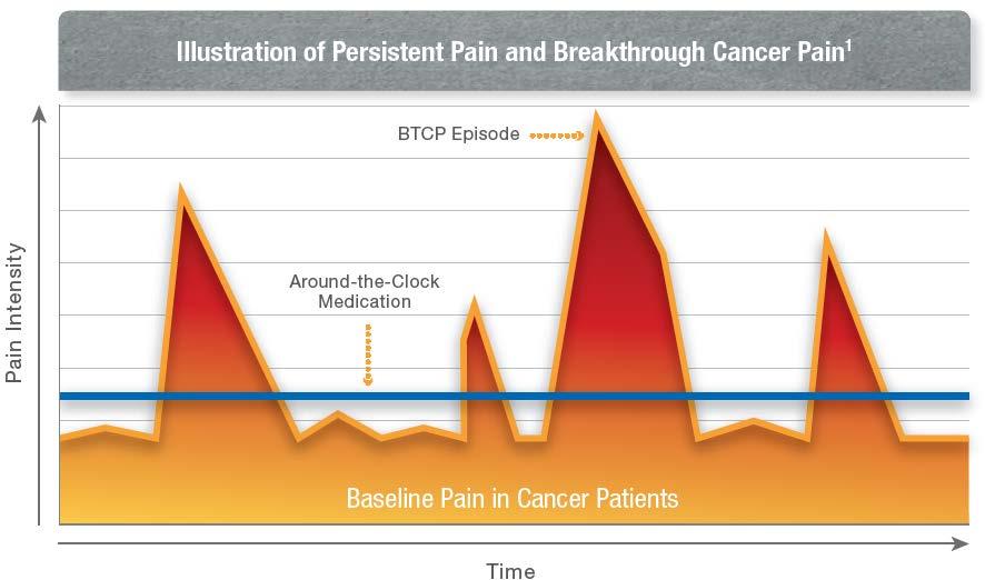 Characteristics of Breakthrough Cancer Pain (BTCP) Characteristics can vary widely among patients 1-6 Severity 1-6 Often severe or excruciating Time to peak pain intensity (median) 1,2,4-6 <1 to 10