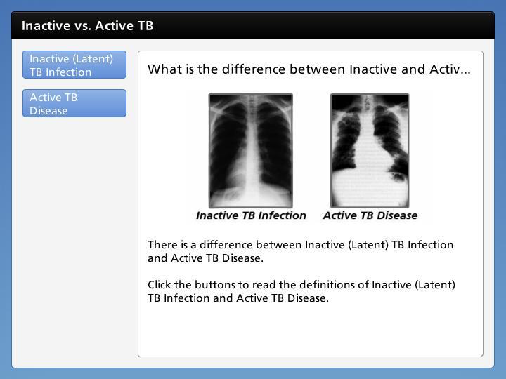 Slide 6 It is important to understand that there is a difference between Inactive (Latent) TB Infection and Active TB Disease. Everyday, we breathe in disease-producing bacteria.