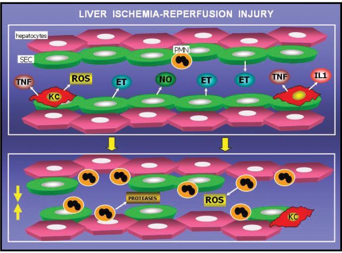 Steatosis sensibilizes liver to ischemia-reperfusion lesions through altered