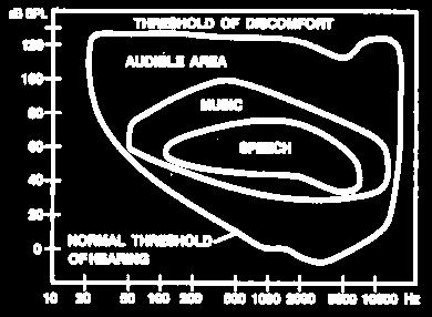 2.1 Audiogram: An audiogram is a graph plotted during the hearing test shows the softest sound a person can hear at different pitches or frequencies.