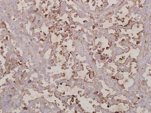 ) in the 2 groups at variable time points of analysis after immunohistochemical staining. 1 2 3 