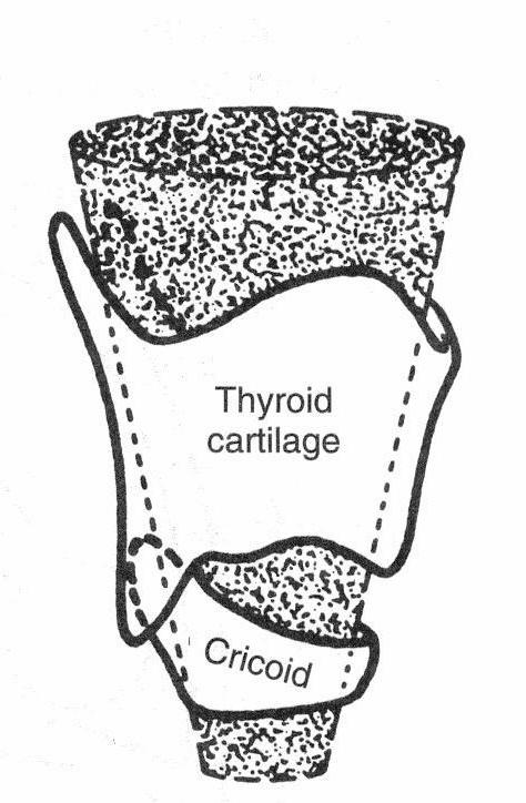 Myths and Infantile Larynx