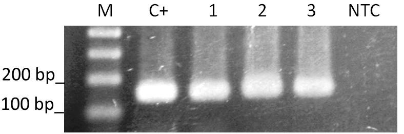 M.A.R. Silva et al. 3154 Figure 2. Representative E5 bovine papillomavirus (BPV) expression in cattle blood. RT-PCR for E5 BPV gene.