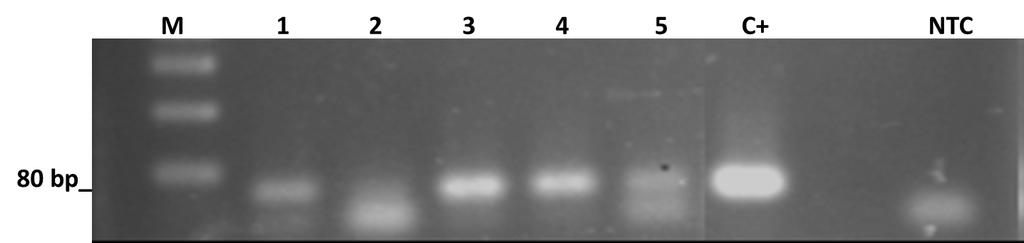 Representative E2 bovine papillomavirus (BPV) expression in cattle blood. RT-PCR for E2 gene.