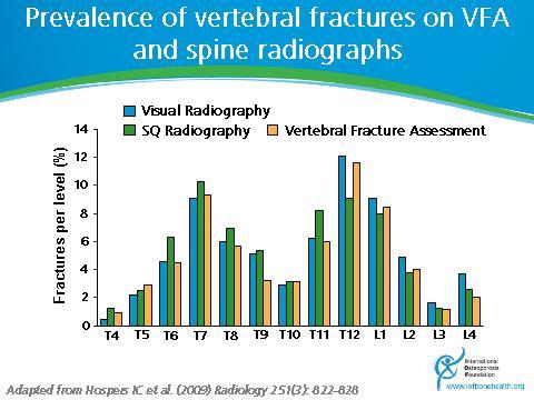 pdf Slide 42-43 Endplate depression is central to definition of a vertebral fracture ABQ is a qualitative method developed to avoid labeling vertebral bodies with short vertebral height as fractured