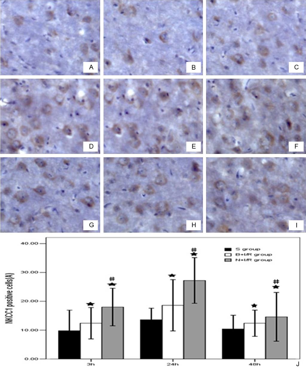 Figure 4. Bumetanide down-regulates the NKCC1 protein expression level in rat brain cortex. A-C. Respectively were sham group rats at 3h, 24h, 48h. D-F were saline group, G-I were bumetanide groups.