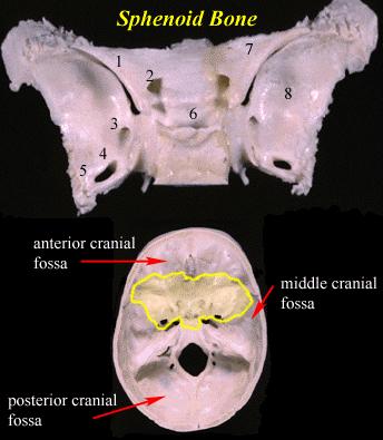 10 E. The sphenoid The sphenoid lies in the base of the skull forming part of the floor of the middle cranial fossa. On its upper surface the bone carries a chamber for the pituitary gland.