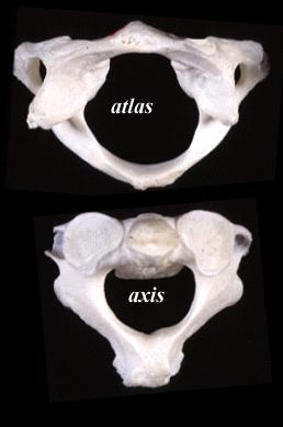 16 2. Axis (C2) The Axis is the second cervical vertebra or C2. It is a blunt tooth like process that projects upward. It is also referred to as the dens (Latin for tooth ) or odontoid process.
