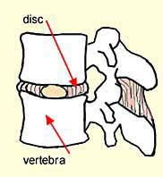 23 Intervertebral disc Front View View from Above Side View The