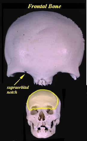 6 1. Parietal Bone 2. Temporal Bone 3. Occipital Bone 4. Mandible Maxilla 5. Frontal Bone Sphenoid 6. Bone zygomatic bone A.