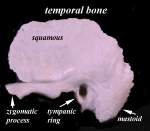8 C. Temporal bone The temporal bone has a vertical squamous part forming part of the side of the skull, and a horizontal base, the petrous temporal bone.