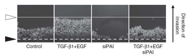 Oris Invasion Assays Help Unravel Complex Signal Transduction Mechanisms TGF- 1 & EGF synergize to
