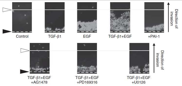 transduction inhibitors attenuate TGF- 1 & EGF induced invasion Plasminogen Activator Inhibitor -1