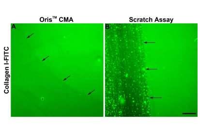 Cell Motility Assay Competition - Scratch Assays Oris