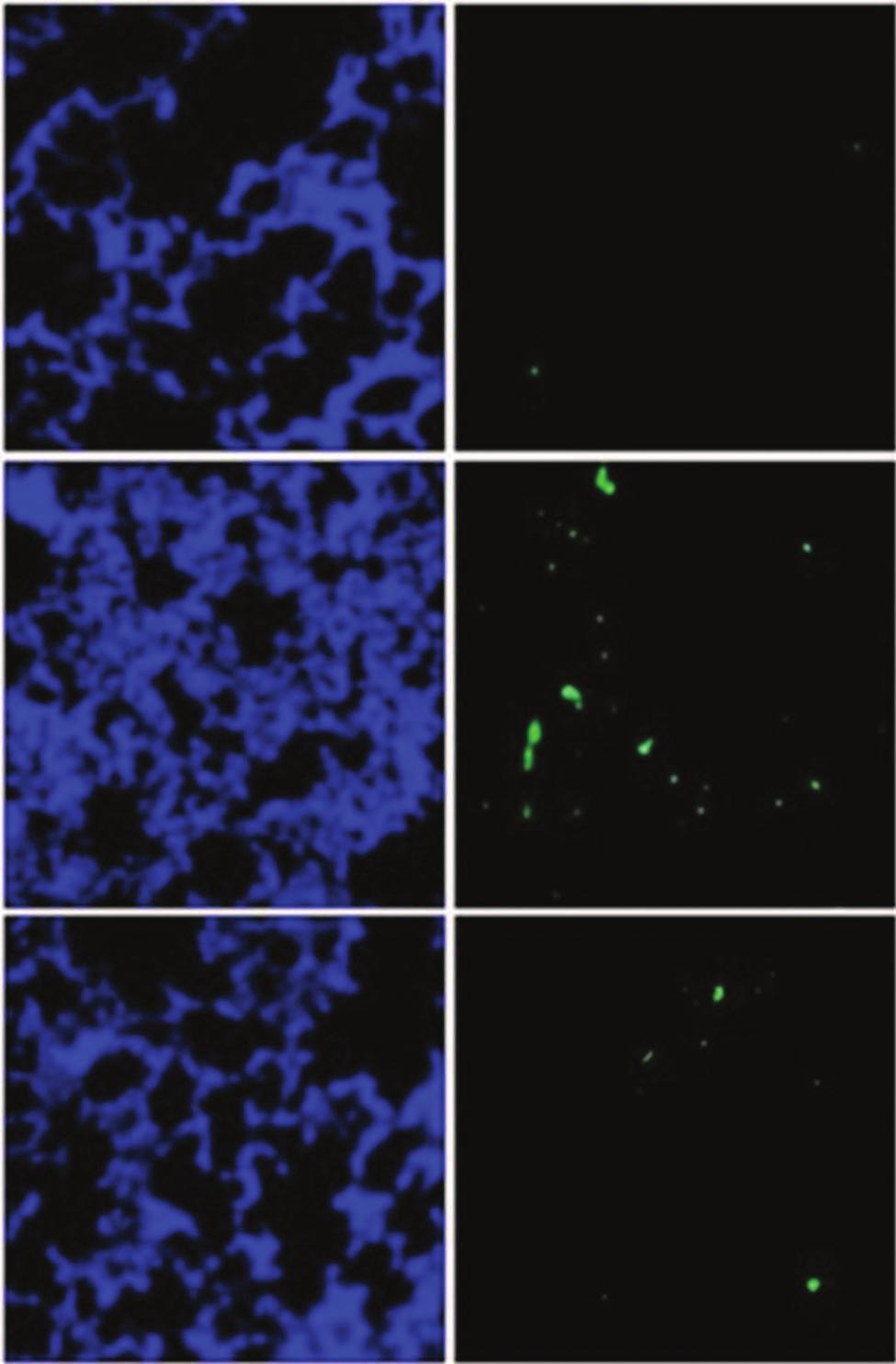 Fig. 8. Expression of Bcl-xl and Bax in the lung tissues.