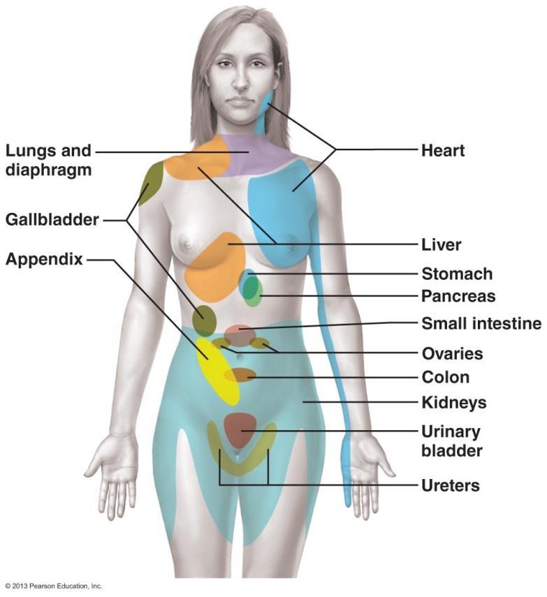 REFERRED PAIN A painful sensation felt in a region of the body that is not the origin of the stimuli.