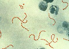 Streptococcus pyogenes From Wikipedia, the free encyclopedia Streptococcus pyogenes S. pyogenes bacteria at 900x magnification.