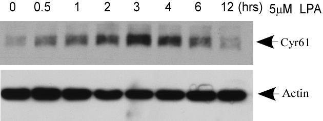 Cyr61 protein level was determined by western blotting with 10% SDS PAGE gel. Actin was used as the loading control. Figure 2.