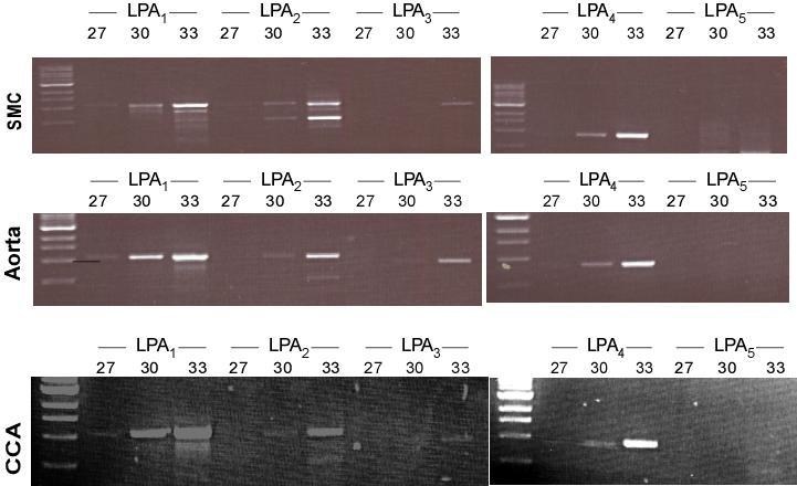 Figure 4. R-T PCR results, LPA1-5 receptor expression in MASMCs, mouse aortas and carotid arteries.