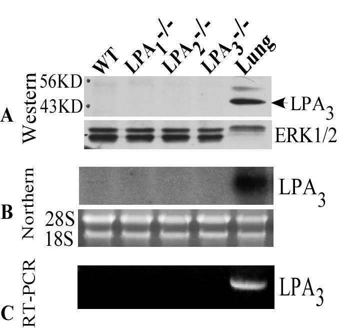 Figure 6. A. Western blot analysis showing LPA3 receptor expression in WT, LPA1-/-, LPA2-/- and LPA3-/- MASMCs.