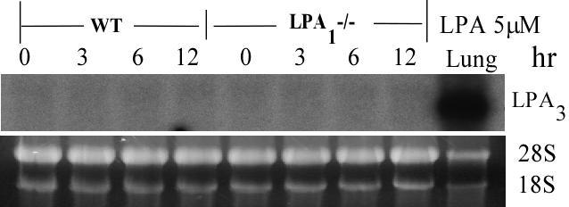 Figure 7. Northern blot analysis data: LPA 3 expression levels in WT, LPA -/- 1 MASMCs after stimulation with LPA.