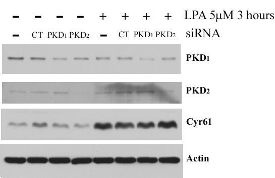 Cyr61 protein level was determined by Western blotting with 10% SDS-PAGE gel. Actin level was used as the loading control. Figure 19.
