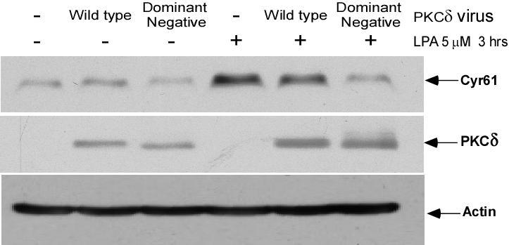 Figure 28. Infection of PKC dominant negative adenovirus blocks LPA-induced Cyr61 protein expression in MASMCs.