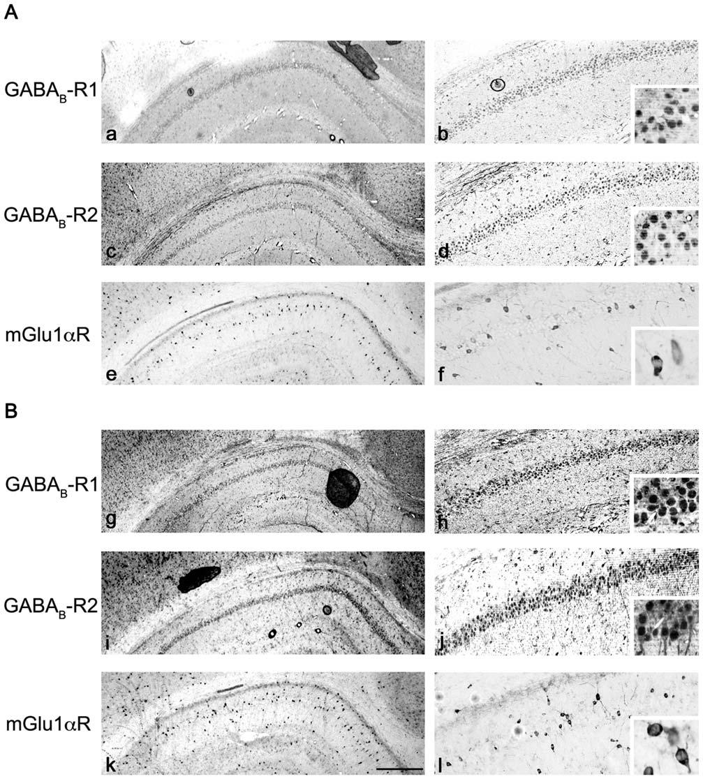 Figure 7. Immunohistochemical analysis of the expression of GABA B -R1/R2 and mglu1ars in normally sleeping (NS) and sleepdeprived (SD) rats.